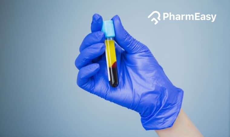 PDW Blood Test: Purpose, Results & What It Means