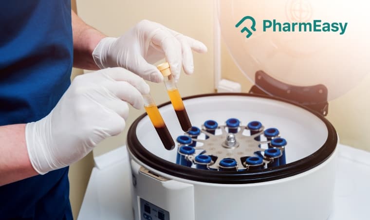 Low Platelet Count: Causes and How to Improve Them