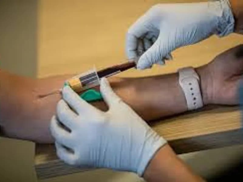 Albumin Drain Fluid Test: What It Is & Why It Matters