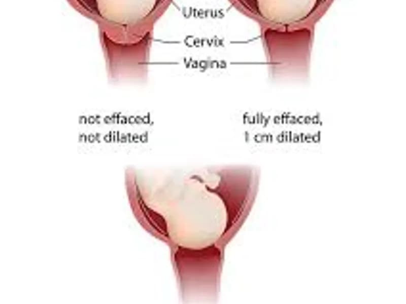9 Month Pregnancy Delivery Without Pain Guide
