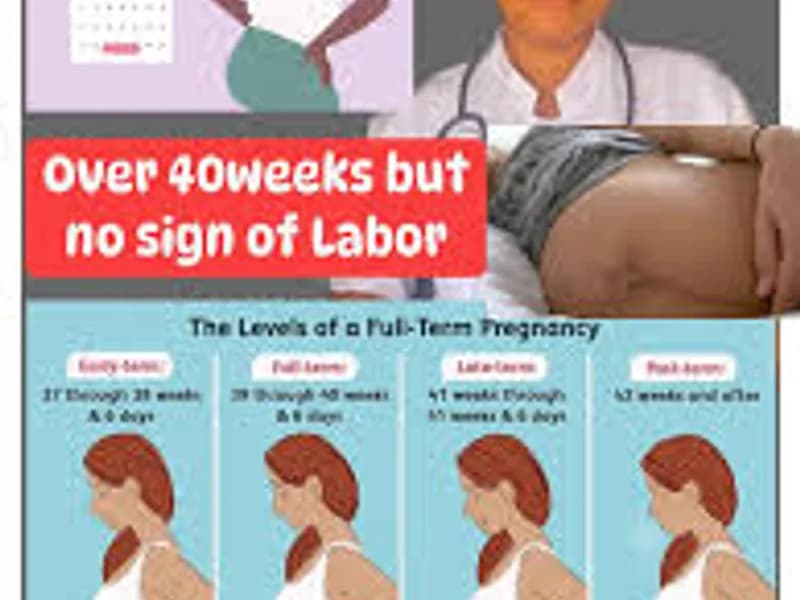 Labour not starting at 40 weeks: what to do