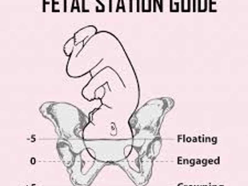 Baby Not Engaged at 9 Months Pregnancy: What to Know