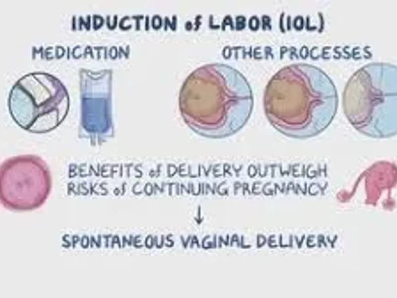 Induction of Labor Methods: What Actually Works