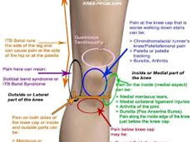 Knee Pain Physiotherapy in Bokaro: Expert Care for Relief