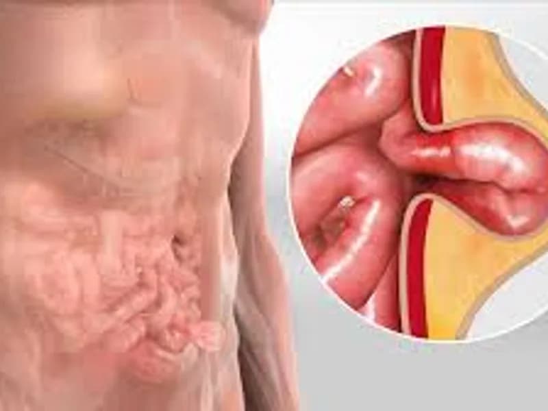 Best Hernia Specialist in Kolkata: Top Laparoscopic Care