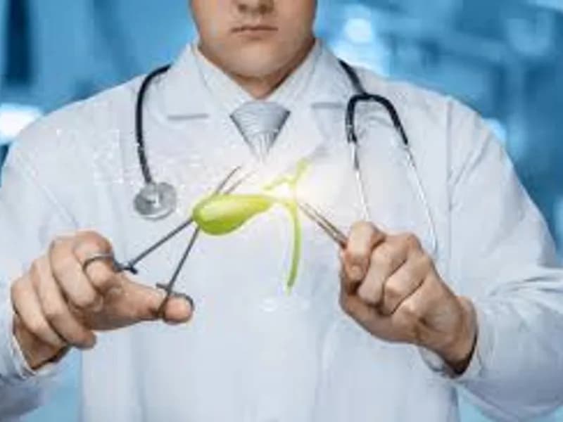 Best Gallstone Doctor in Kolkata: Top Gallbladder Care