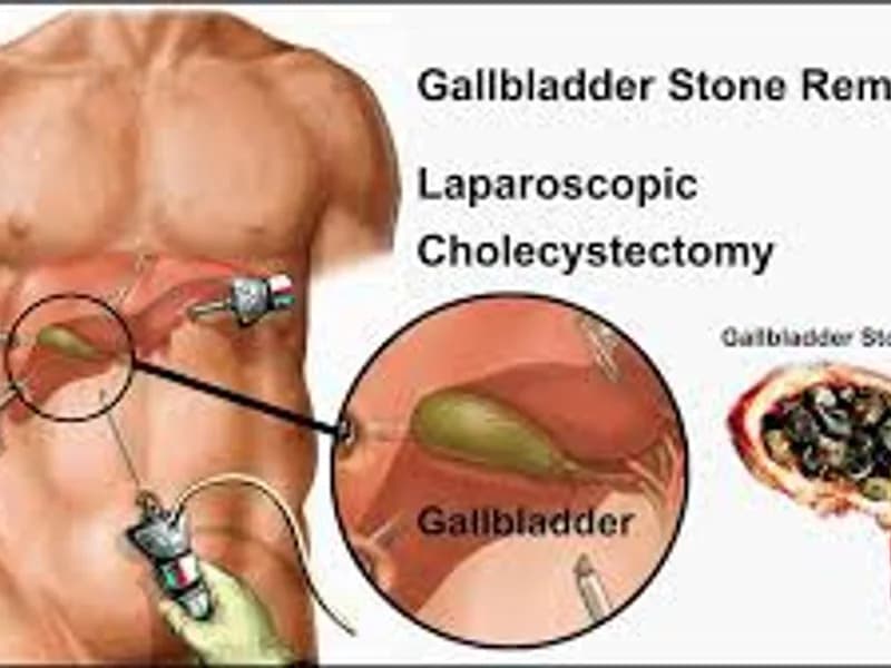 Best Gallbladder Problem Specialist in Kolkata: Top Care