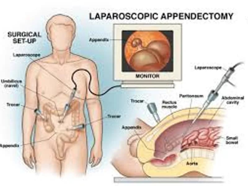 Best Appendix Surgeon in Kolkata: Top Expert Care