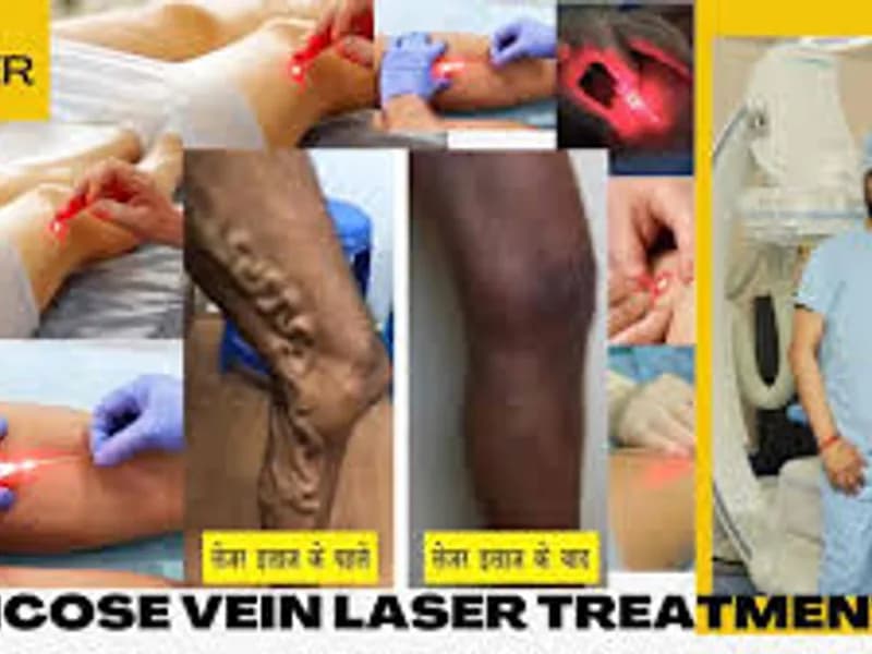 Best Vein Problem Specialist in Kolkata: Top Vascular Care