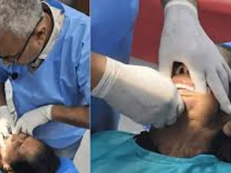 Best Dental Implant Doctor India: Top Tooth Restorations