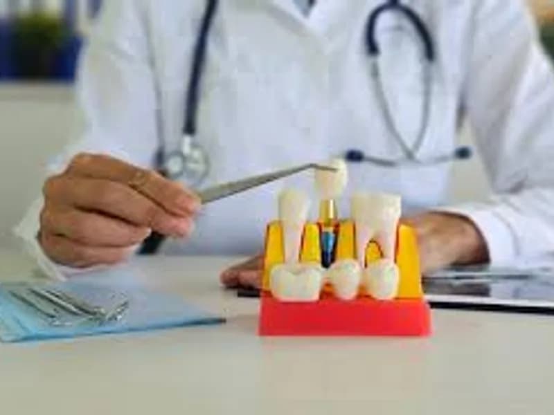 Best Dental Crown Doctor: Expert Tooth Restorations