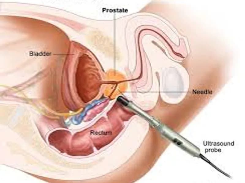 Rectal Biopsy Surgery in Deoghar | Best Pediatric Surgeons & Diagnostic Procedure Cost