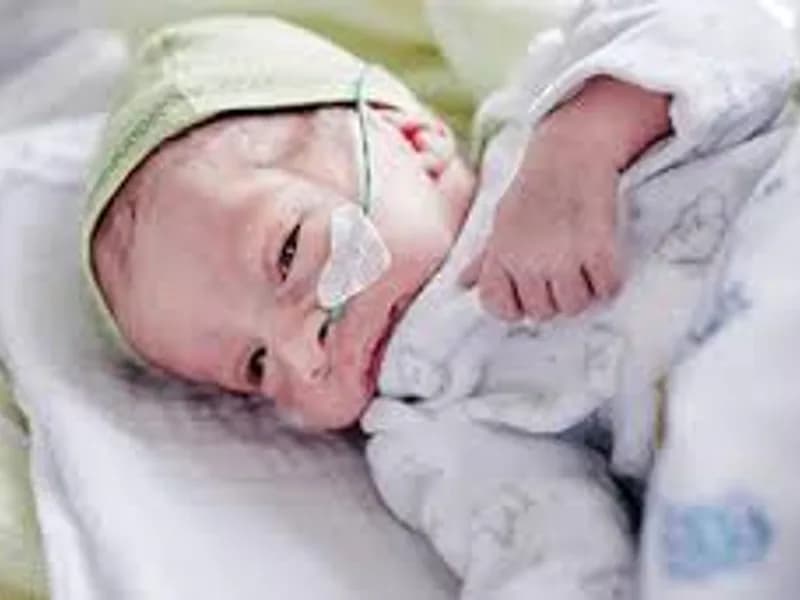 Child children hospital in Deoghar 2