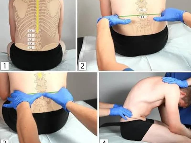 Female Lumbar Puncture in Dhanbad