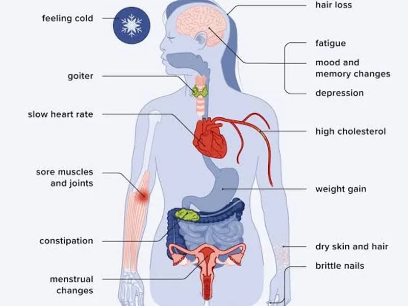 Hypothyroidism: Causes, Symptoms & Treatment Guide