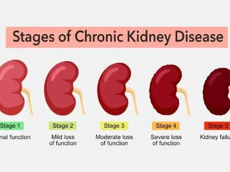 Chronic Kidney Disease: Symptoms, Causes & Treatment