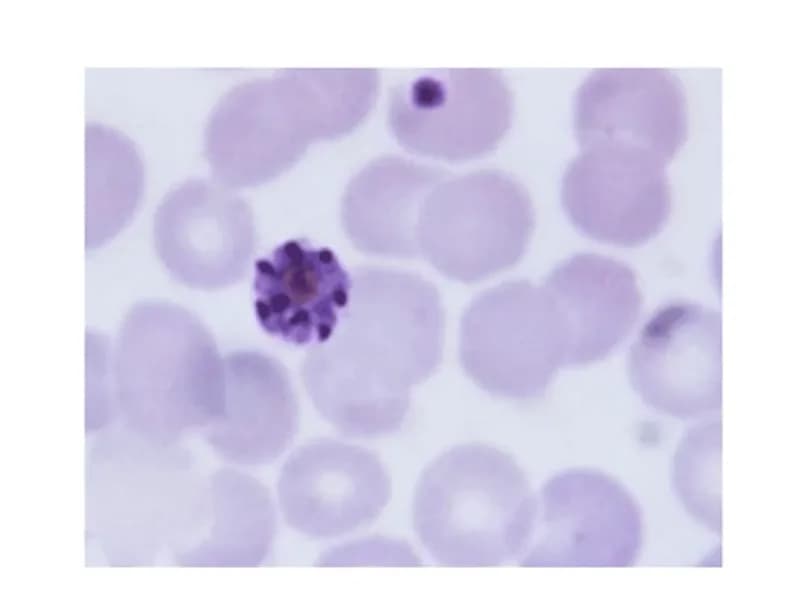 Peripheral Blood Smear for Malaria: A Detailed Guide
