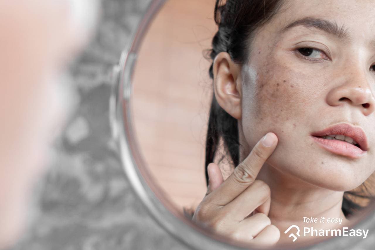 Fade Dark Spots: Expert Tips for Brighter Indian Skin