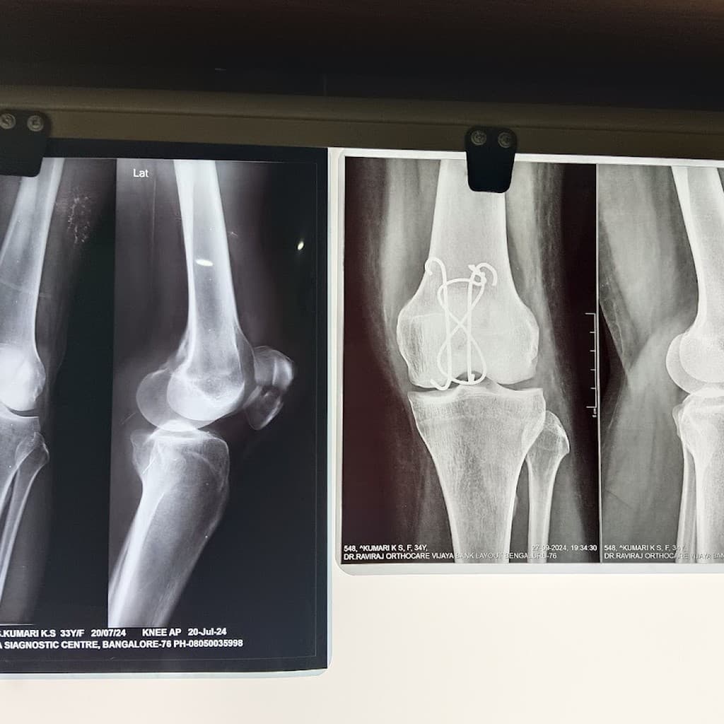 Dr RaviRaj OrthoCare