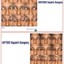 DR AGARWAL EYE HOSPITAL - CEDS