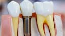 Dr Ravi Dental Clinic Best Dental Clinic in Ambattur ( k k road, Venkatapuram) Chennai Clinic