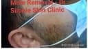 Dr Silonie Skin and Laser Clinic (USA trained, Appointment compulsory .Best Botox / Fillers / Laser) Clinic