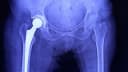 Dr Debasish Naskar- Knee replacement surgeon Clinic