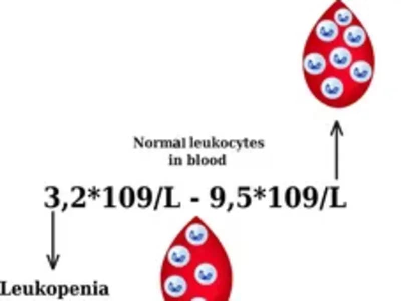 What is Leukocytosis? Understanding High White Blood Cell Counts
